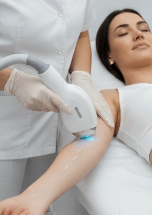 Diot Buz Lazer Epilasyon